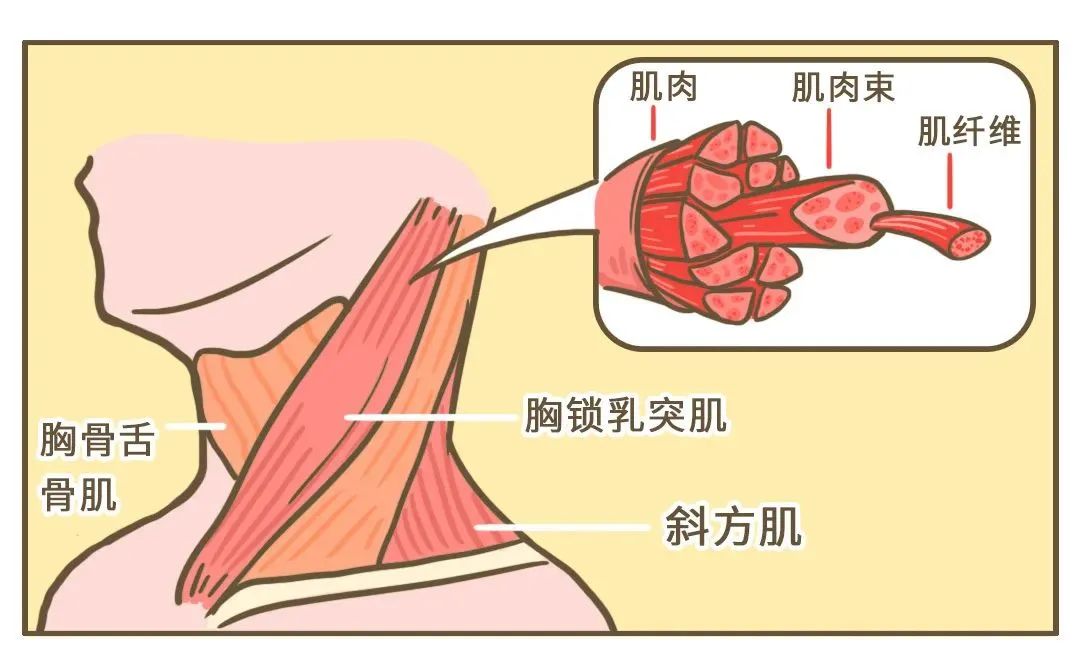 脖子落枕是在喊救命出现这些症状要小心