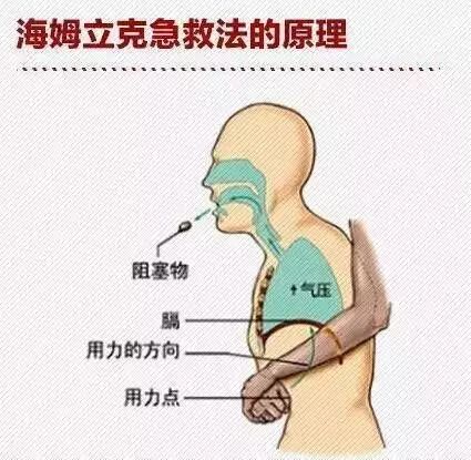 深圳2岁男孩吃瓜子险酿悲剧快过年孩子吃这些看着点